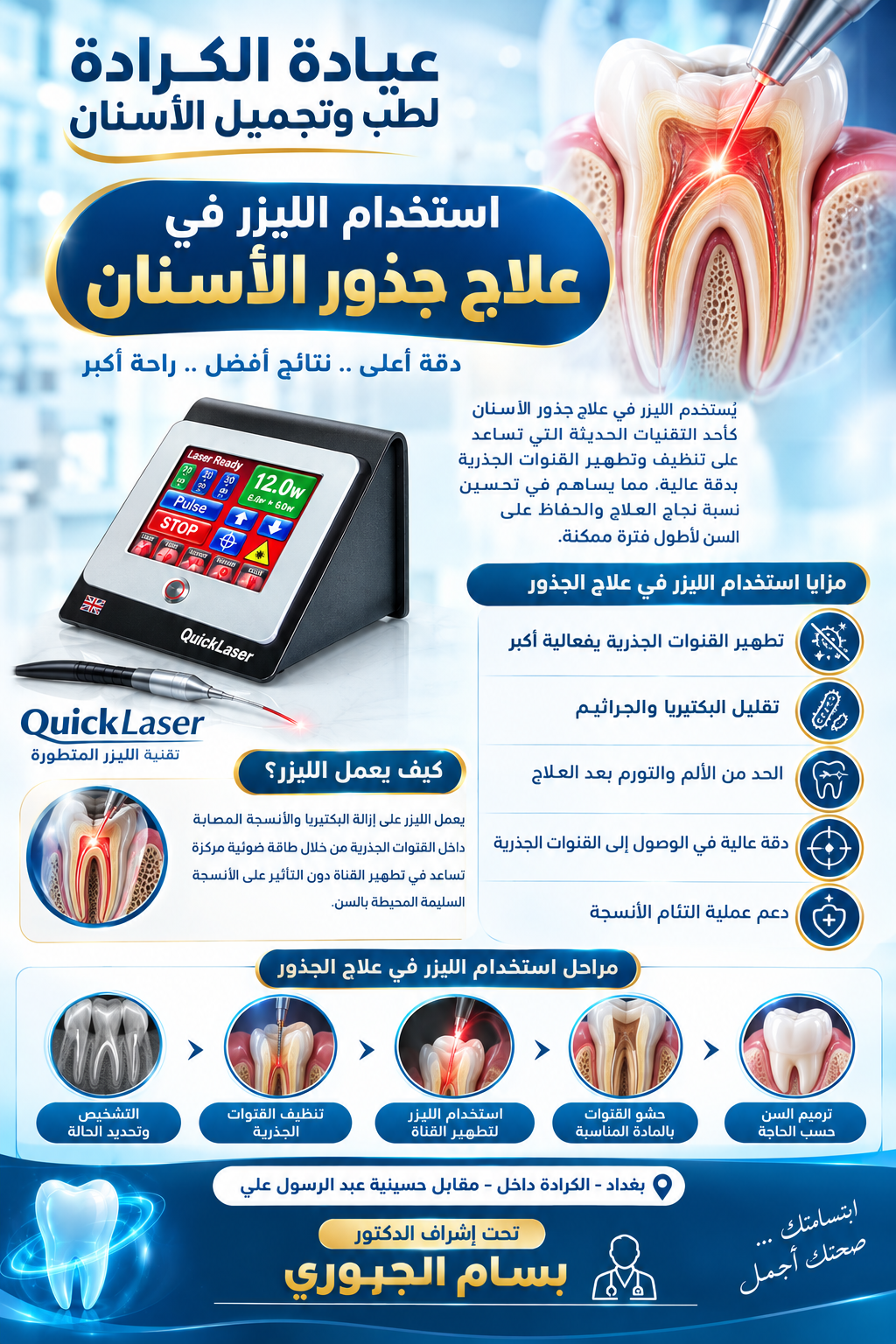 تطهير قنوات الجذور بالليزر في حالات إعادة علاج العصب في عيادة الكرادة