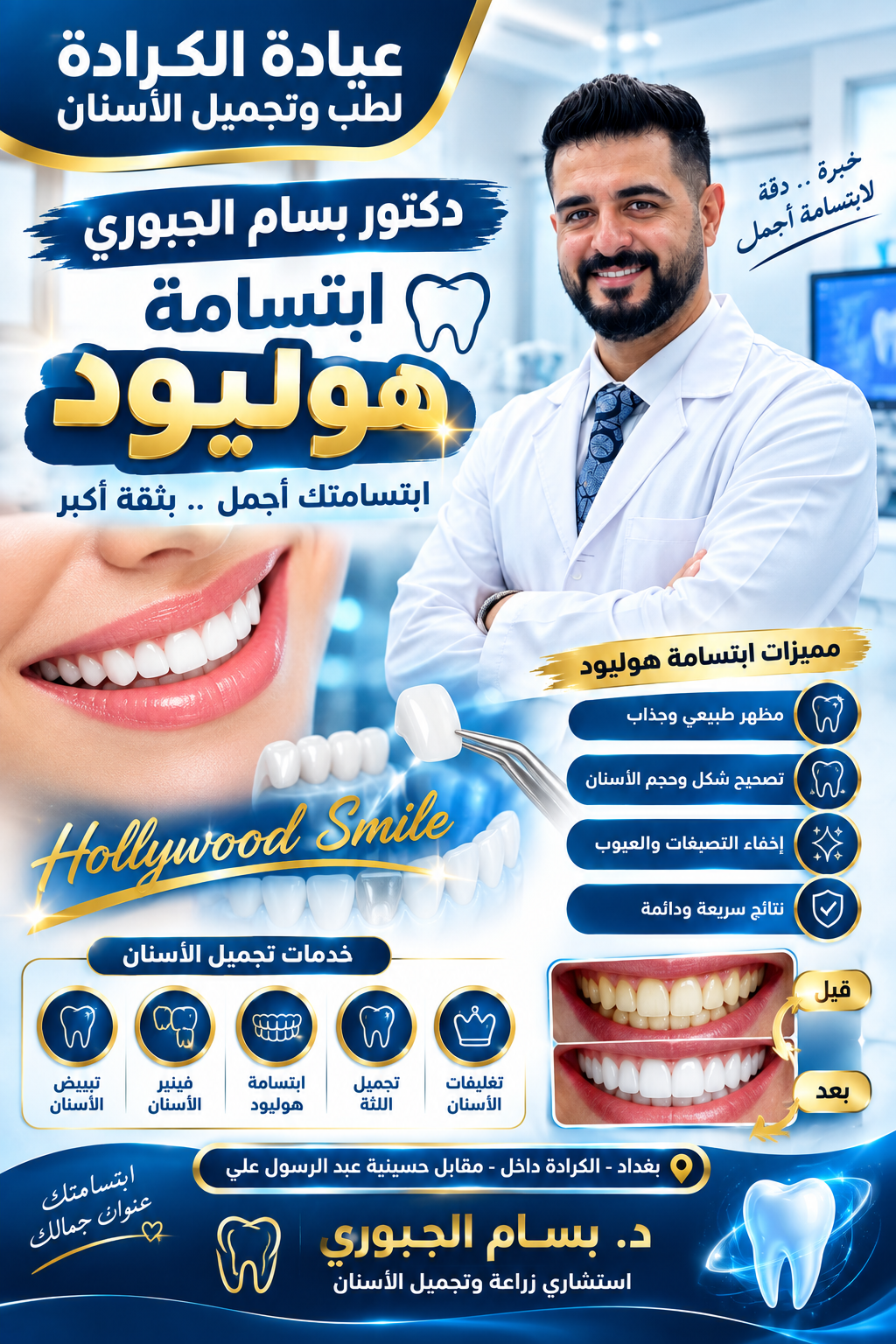 دكتور بسام الجبوري ابتسامة هوليود