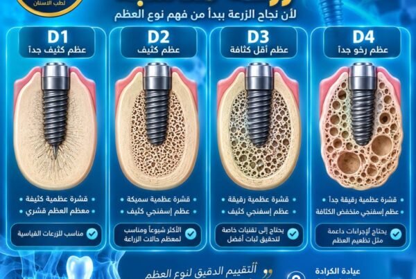 تصنيف أنواع العظم لزراعة الأسنان D1 D2 D3 D4 دكتور بسام الجبوري