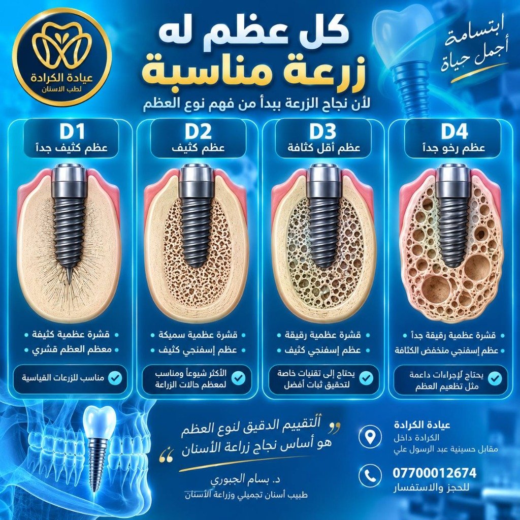 تصنيف أنواع العظم لزراعة الأسنان D1 D2 D3 D4 دكتور بسام الجبوري