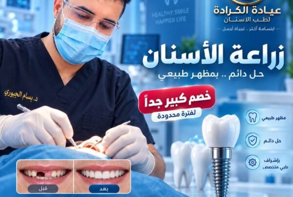 زراعة الأسنان حل دائم بمظهر طبيعي عيادة الكرادة