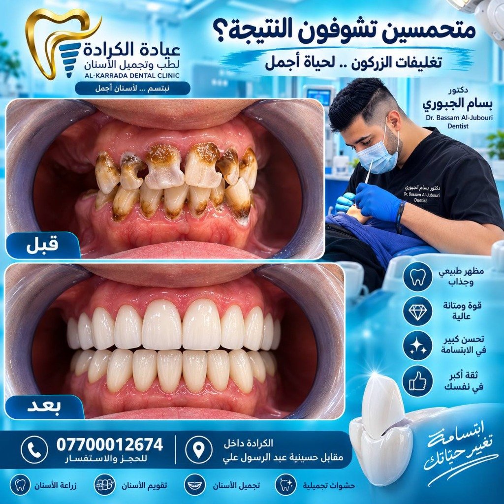 تغليفات الزركون قبل وبعد دكتور بسام الجبوري
